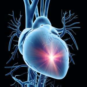 INTERVENCIONES DE ENFERMERÍA EN EL PACIENTE NEONATAL CON CARDIOPATÍAS CONGÉNITAS