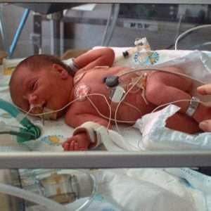 INTERVENCIONES DE ENFERMERÍA EN EL PACIENTE CON SEPSIS NEONATAL